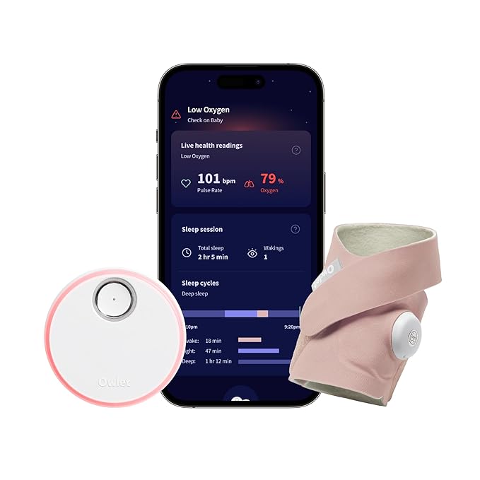 Owlet Dream Sock – Smart FDA-Cleared Baby Monitor (Multiple Color Options)