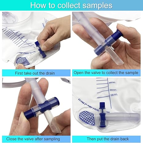 GlobalRoll Urinary Drainage Bag with Anti-Reflux Chamber (2000 mL, 48" Tube)