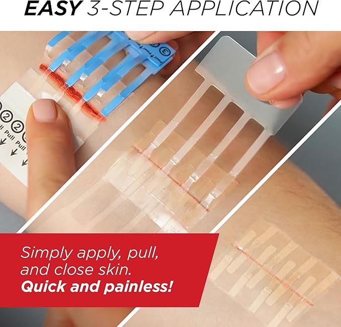 Clozex Emergency Laceration Closures – 3 Piece Assortment