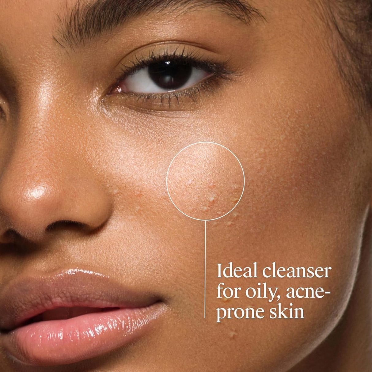 Neutrogena Oil-Free Acne Face Wash with 2% Salicylic Acid, 9.1 fl oz