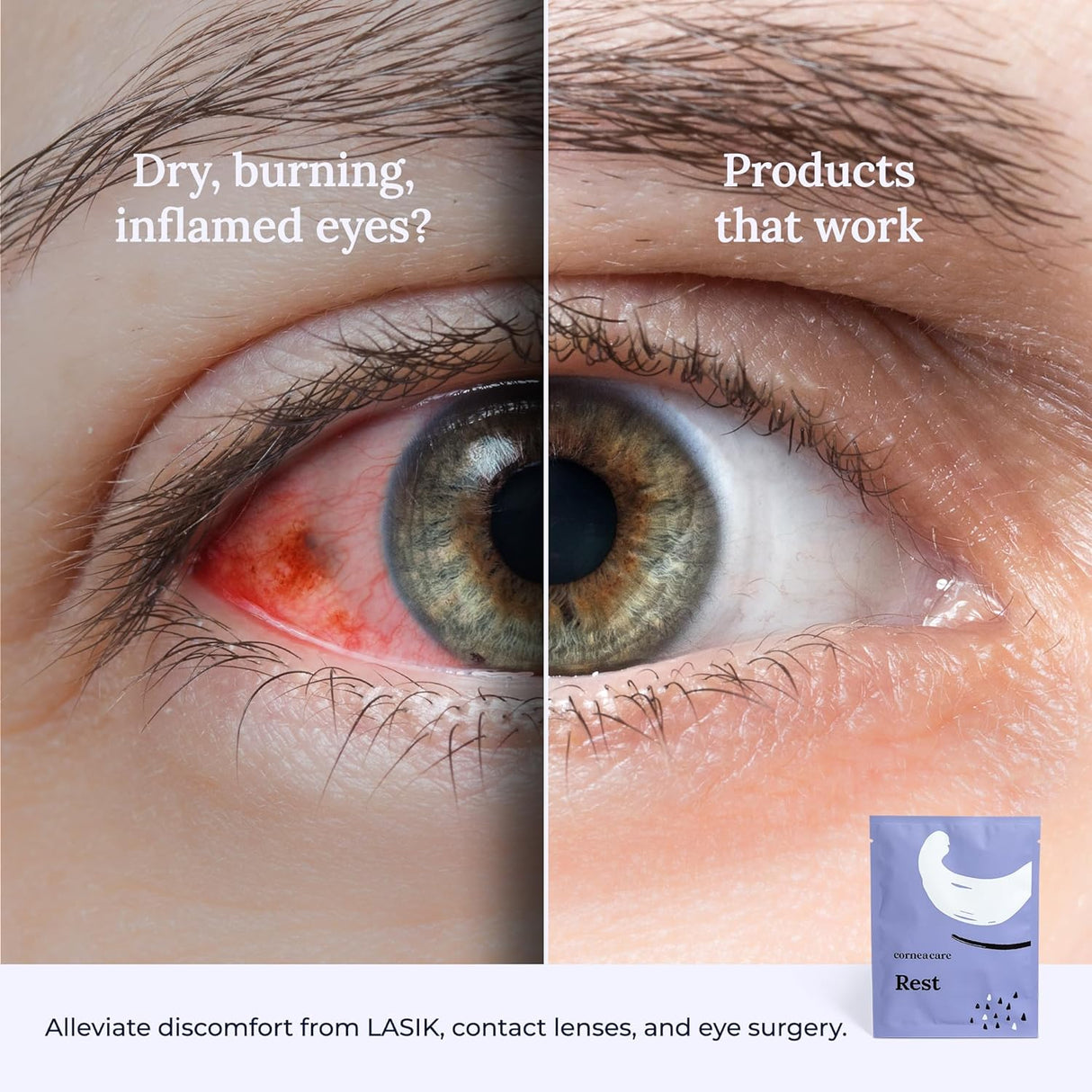 Cornea Care Rest Self Heating Warm Compress for Dry Eyes – 30 Count