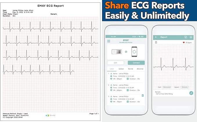 EMAY Portable EKG Monitor