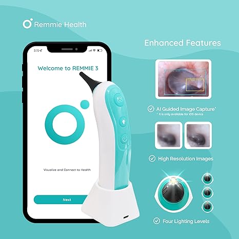 Remmie 3 Otoscope