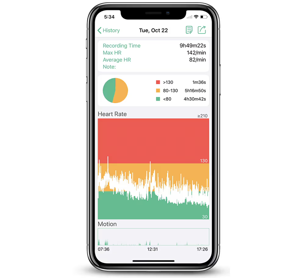 Wellue Strap-Free Heart Rate ECG Monitor