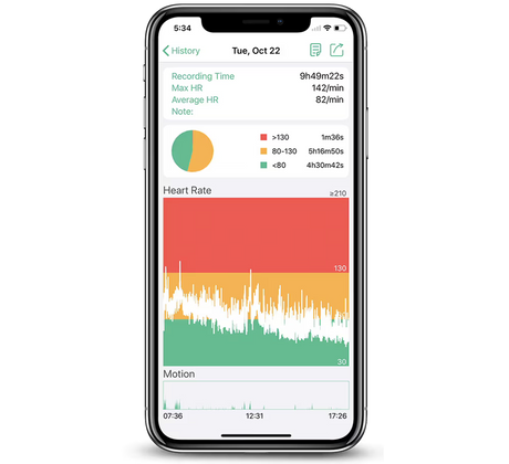 Wellue Strap-Free Heart Rate ECG Monitor