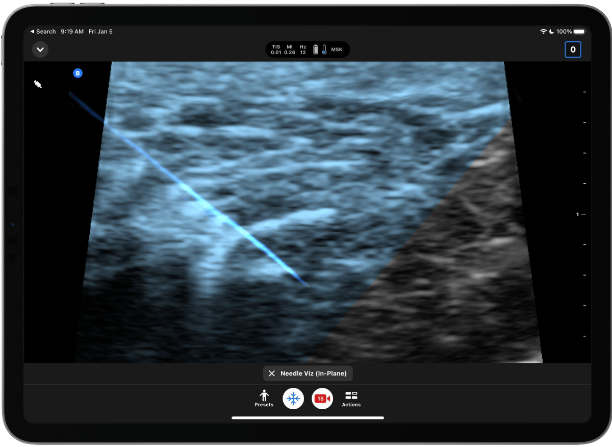 Butterfly iQ3™ Portable Ultrasound Device – 1 or 2 Probes