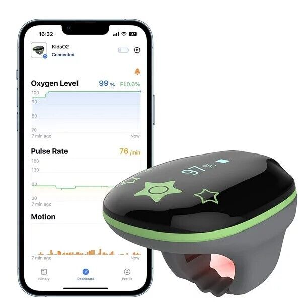Wellue O2Ring Oxygen Monitor (Kids)