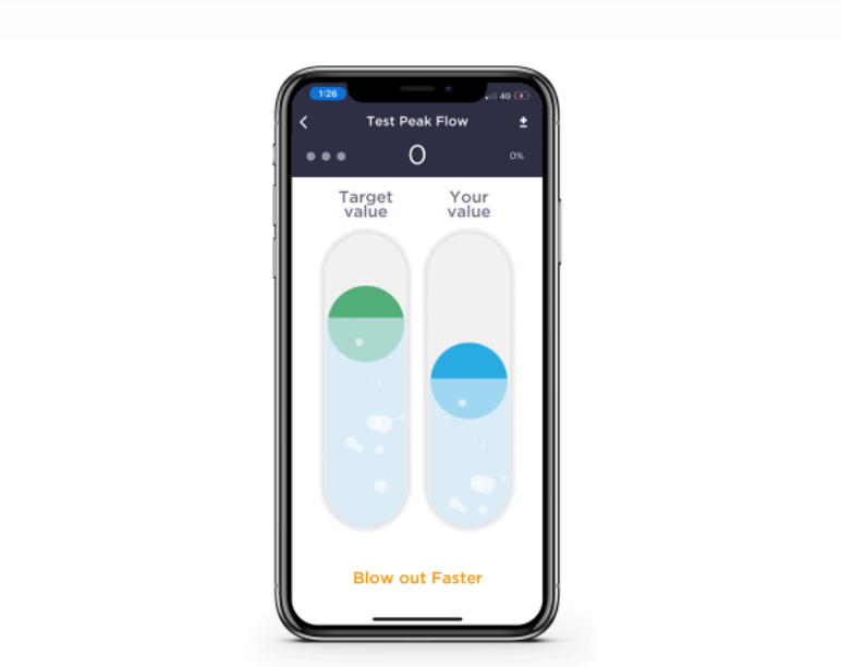 MIR Smart One Spirometer