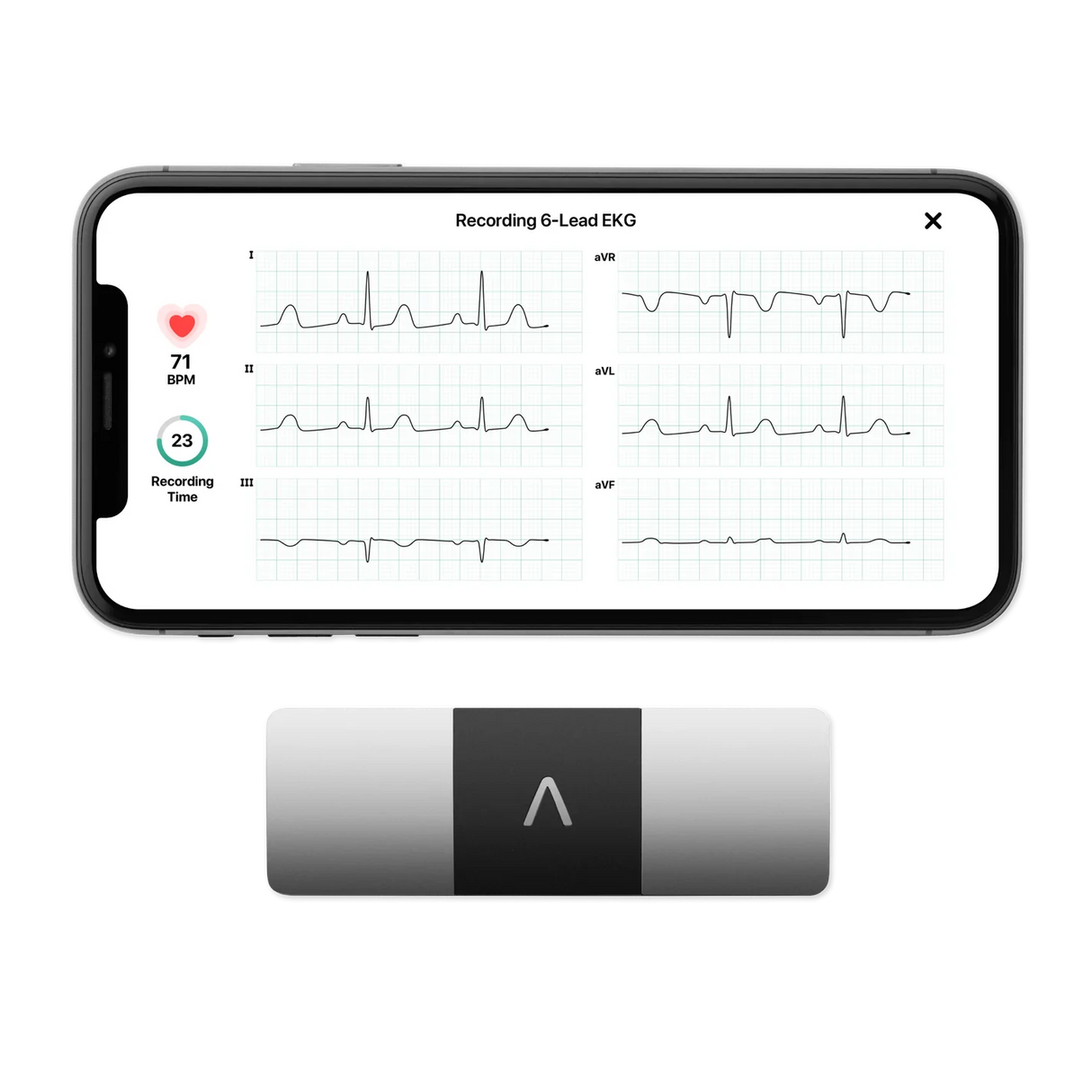 AliveCor KardiaMobile 6 Lead EKG