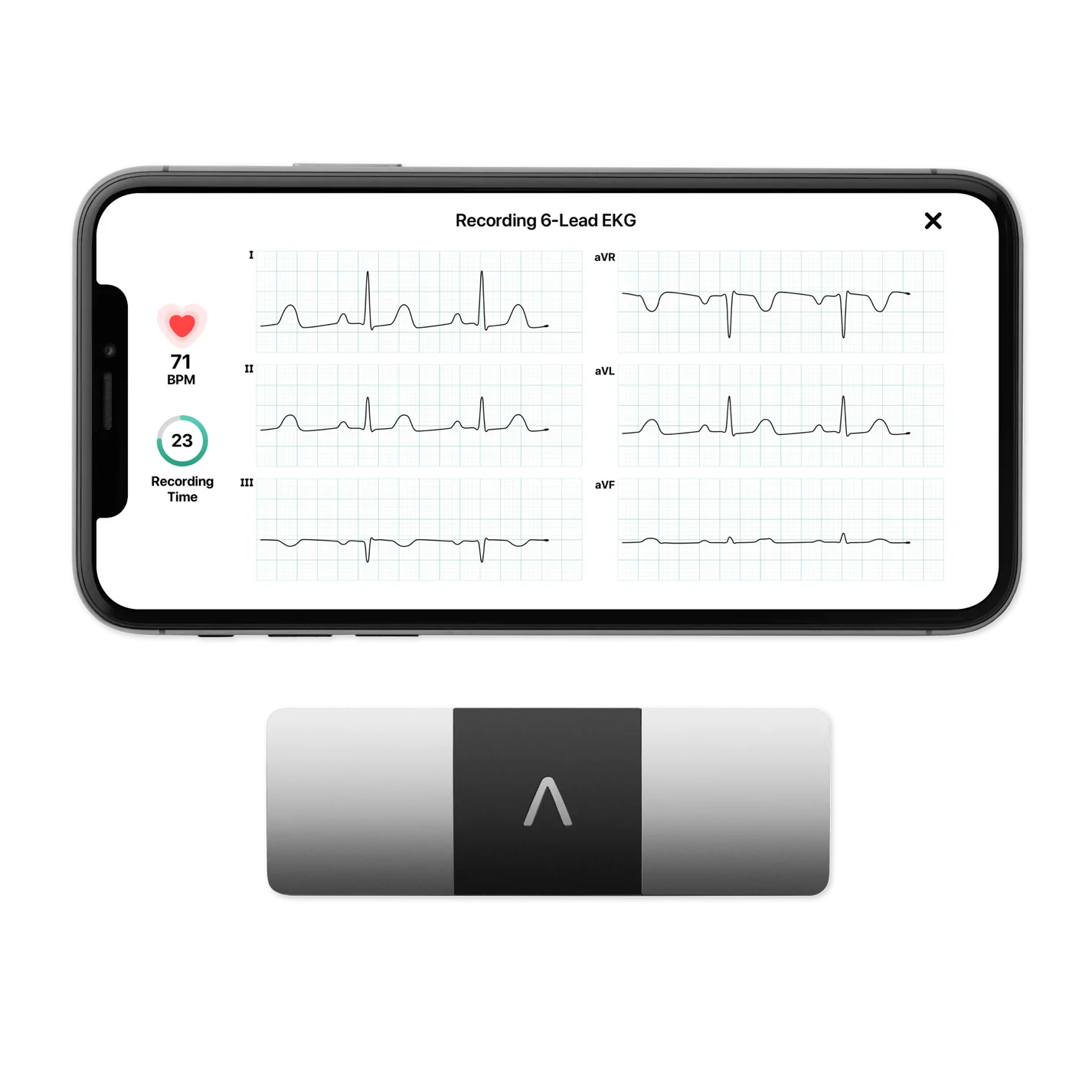 AliveCor KardiaMobile 6 Lead EKG