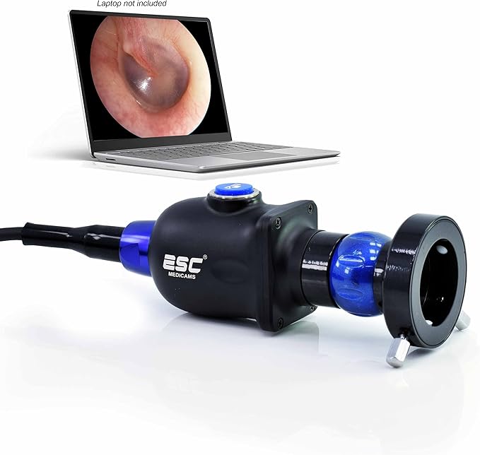ENT-2000US-P Endoscopy Camera – HD Rigid Scope with USB Adapter