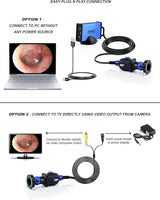 ENT-2000US-P Endoscopy Camera – HD Rigid Scope with USB Adapter