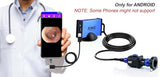 ENT-2000US-P Endoscopy Camera – HD Rigid Scope with USB Adapter