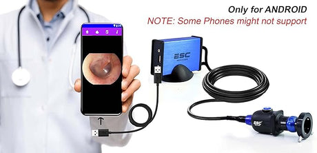 ENT-2000US-P Endoscopy Camera – HD Rigid Scope with USB Adapter