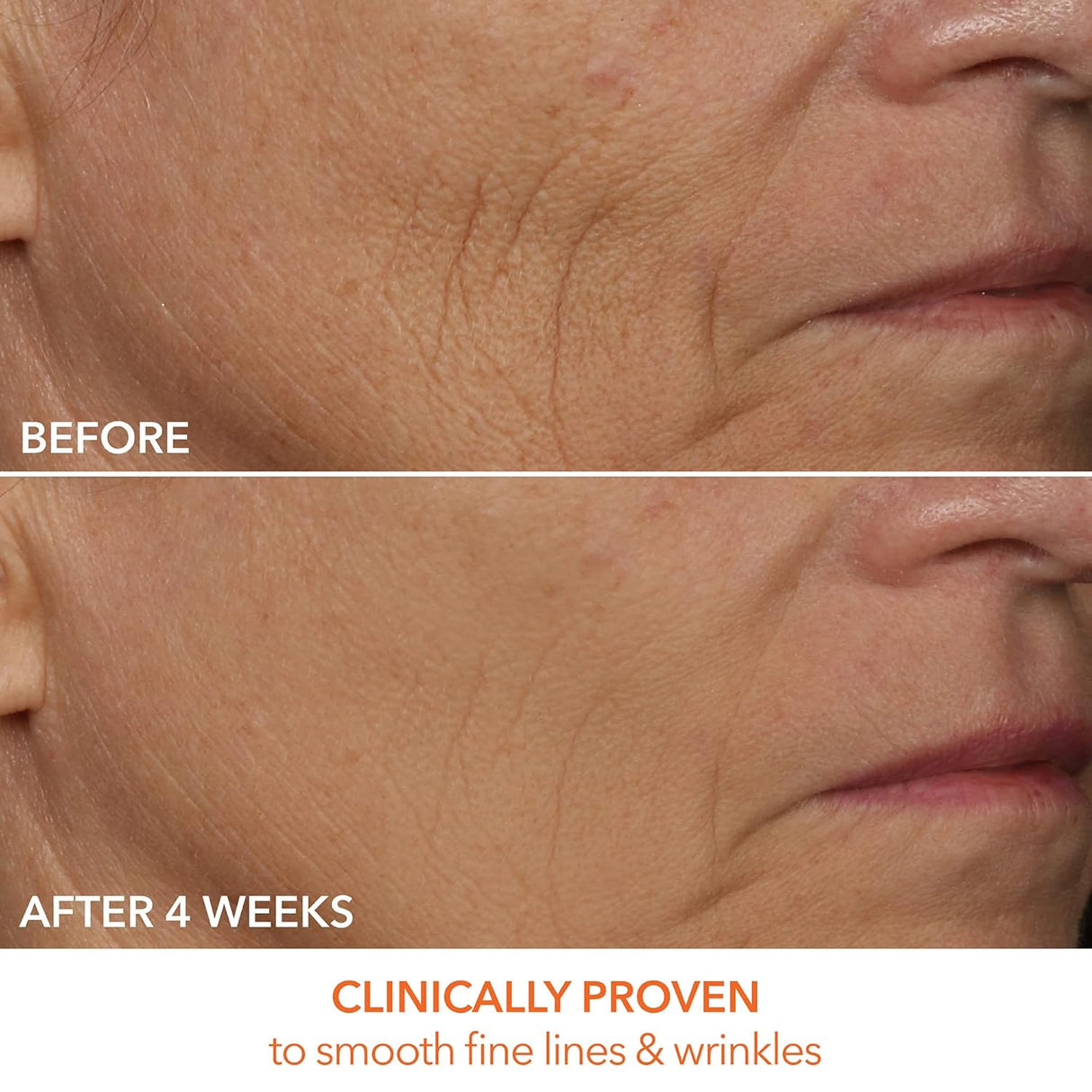 Dr. Dennis Gross DRx FaceWare Pro – LED Anti-Aging & Acne Mask