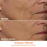 Dr. Dennis Gross DRx FaceWare Pro – LED Anti-Aging & Acne Mask