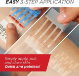 Clozex Emergency Laceration Closures – 3 Piece Assortment