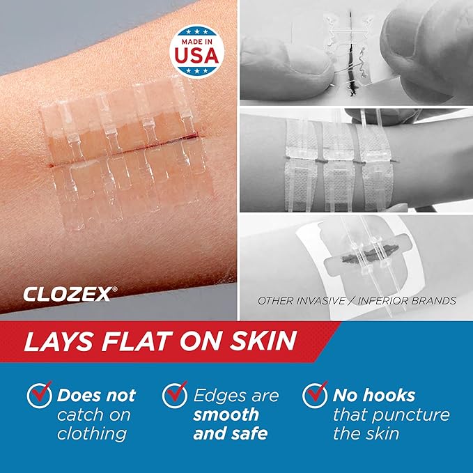 Clozex Emergency Laceration Closures – 3 Piece Assortment