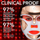 Dr. Dennis Gross DRx FaceWare Pro – LED Anti-Aging & Acne Mask