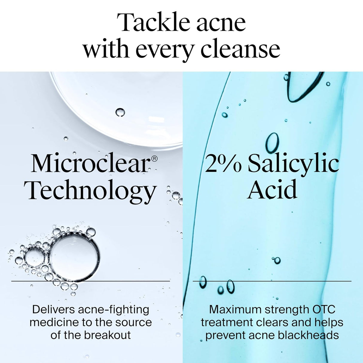 Neutrogena Oil-Free Acne Face Wash with 2% Salicylic Acid, 9.1 fl oz