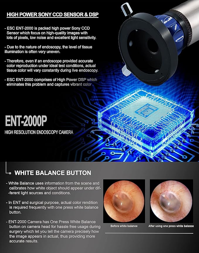 ENT-2000US-P Endoscopy Camera – HD Rigid Scope with USB Adapter