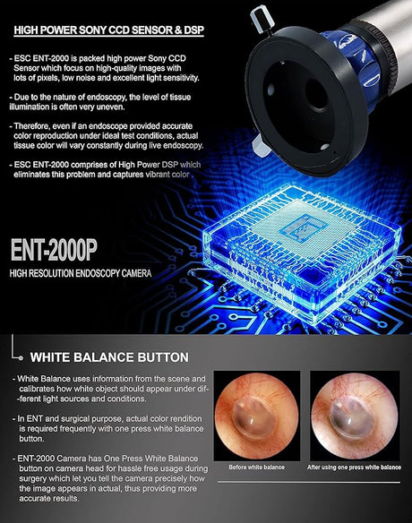 ENT-2000US-P Endoscopy Camera – HD Rigid Scope with USB Adapter