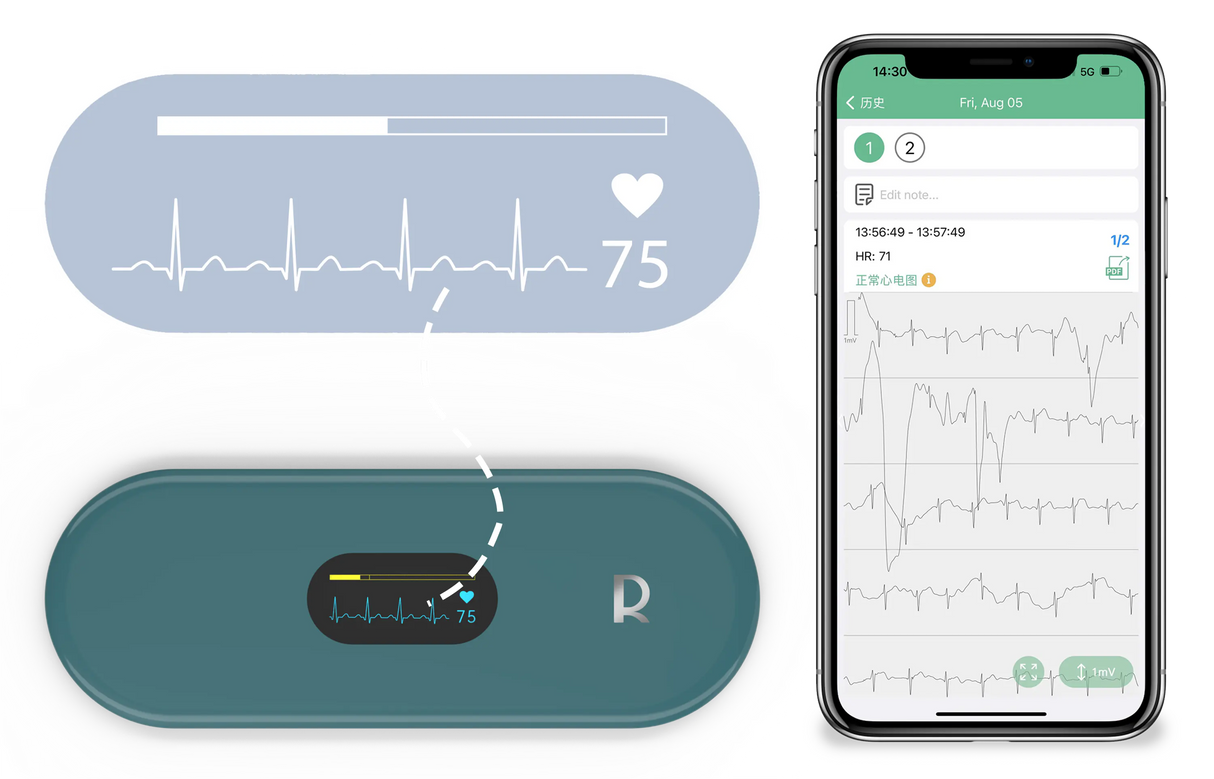 HHM3 ECG Monitor with OLED Screen – App-Connected Tracker