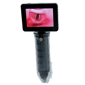 EZ Vision Video Laryngoscope with LCD & Carry Case