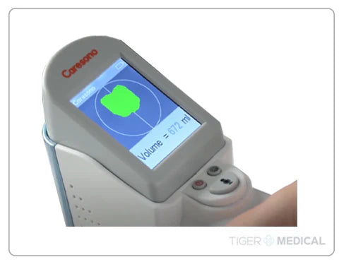 HD2 Handheld Bladder Scanner with Voice Annotation