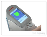 HD2 Handheld Bladder Scanner with Voice Annotation