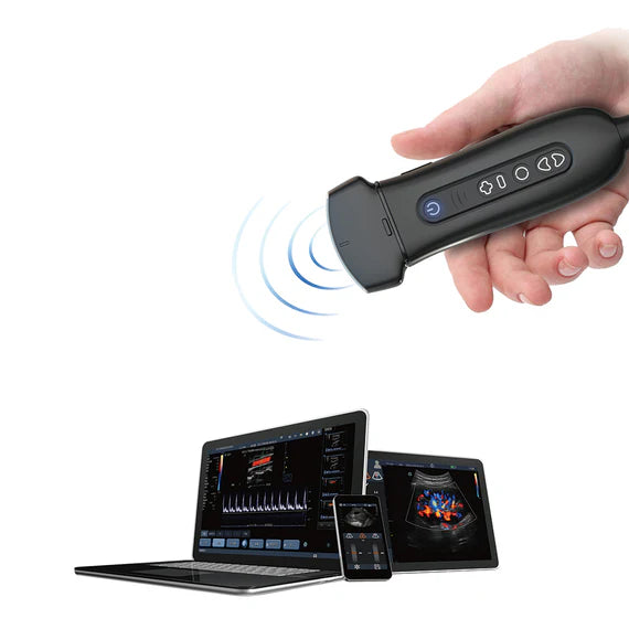 P50 Soloscan Handheld Ultrasound – Main Unit
