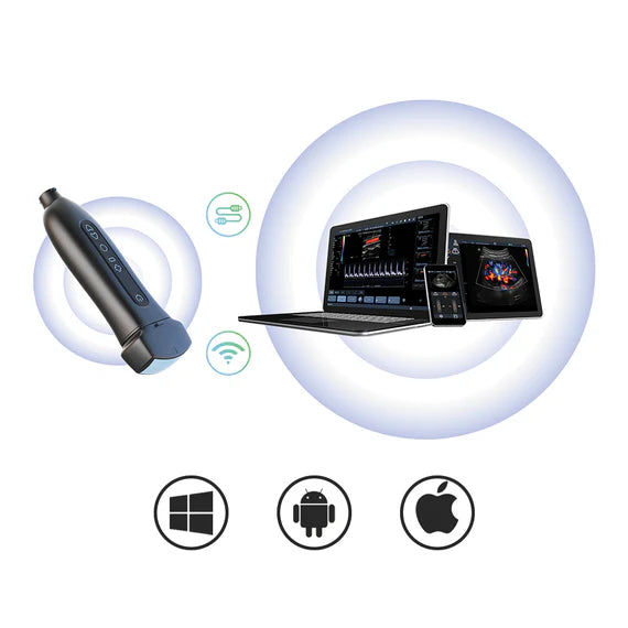P50 Soloscan Handheld Ultrasound – Main Unit