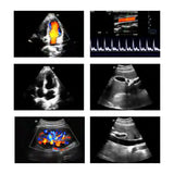 P50 Soloscan Handheld Ultrasound – Main Unit