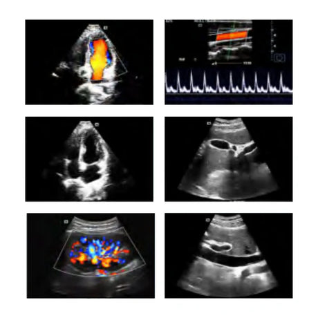 P50 Soloscan Handheld Ultrasound – Main Unit