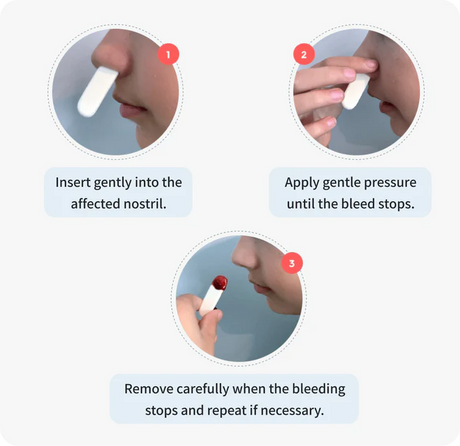 Nampons Kids Nosebleed Stoppers – 12 or 24 Pack, Pediatric Clotting Aid