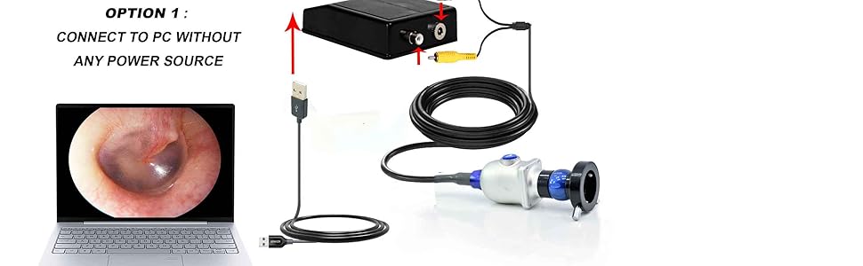 ENT-2000US-P Endoscopy Camera – HD Rigid Scope with USB Adapter