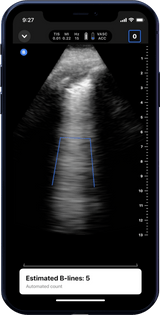 Butterfly iQ3™ Portable Ultrasound Device – 1 or 2 Probes