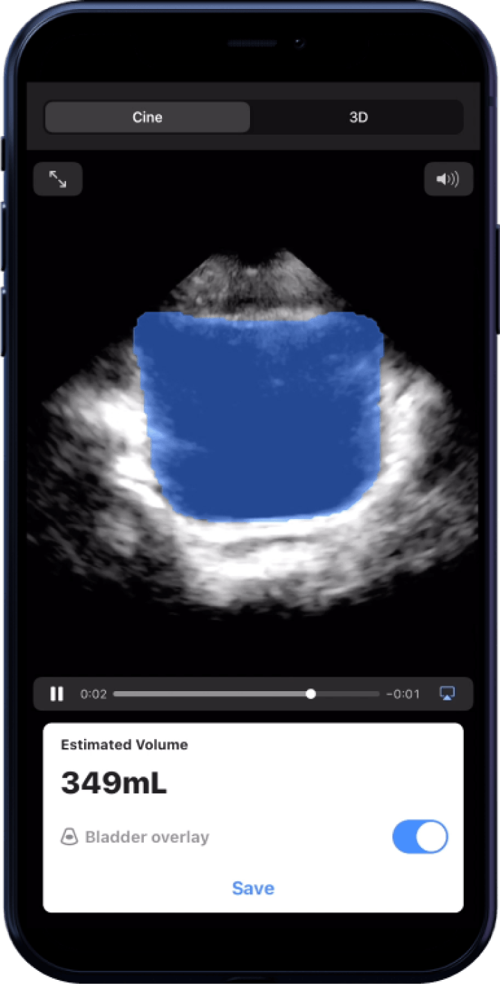 Butterfly iQ3™ Portable Ultrasound Device – 1 or 2 Probes