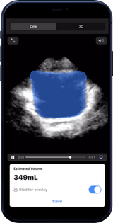 Butterfly iQ3™ Portable Ultrasound Device – 1 or 2 Probes