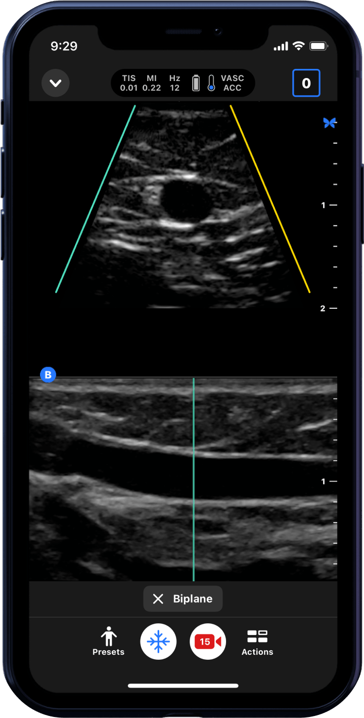 Butterfly iQ3™ Portable Ultrasound Device – 1 or 2 Probes