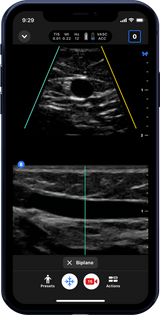 Butterfly iQ3™ Portable Ultrasound Device – 1 or 2 Probes