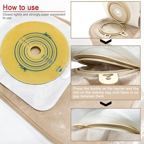 Carbou Ostomy Kit (21 Pcs)