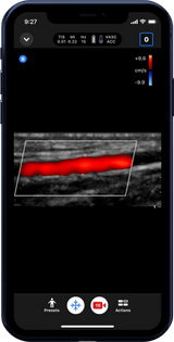 Butterfly iQ3™ Portable Ultrasound Device – 1 or 2 Probes