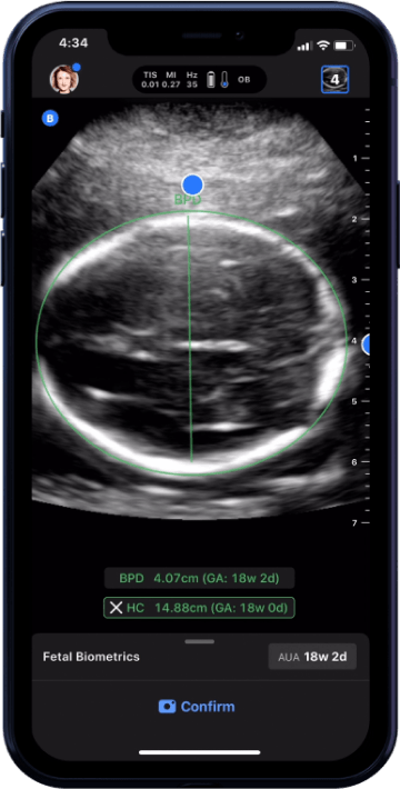 Butterfly iQ3™ Portable Ultrasound Device – 1 or 2 Probes