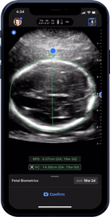 Butterfly iQ3™ Portable Ultrasound Device – 1 or 2 Probes