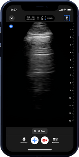 Butterfly iQ3™ Portable Ultrasound Device – 1 or 2 Probes