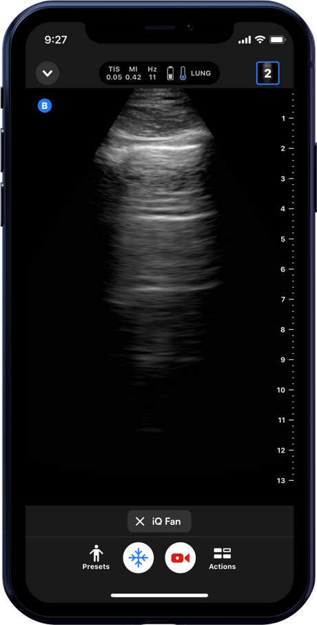 Butterfly iQ3™ Portable Ultrasound Device – 1 or 2 Probes