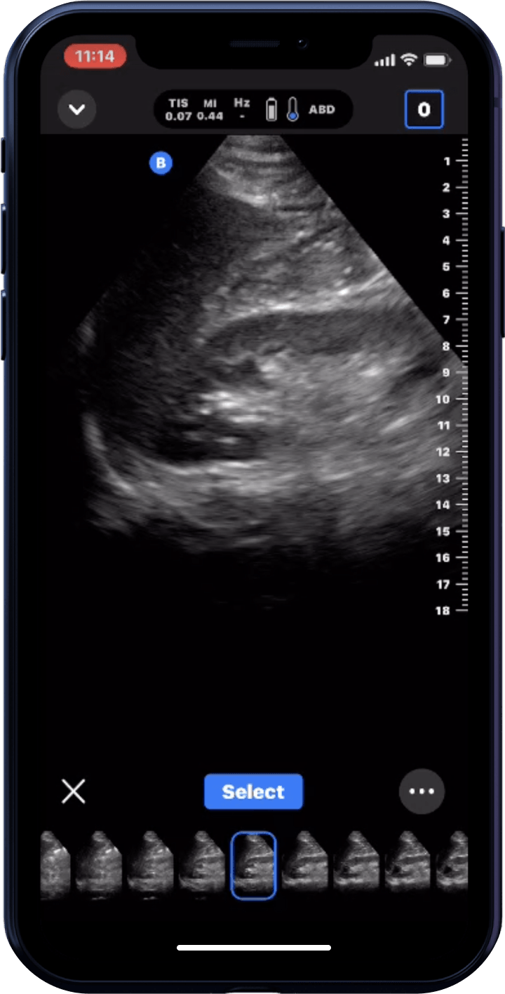 Butterfly iQ3™ Portable Ultrasound Device – 1 or 2 Probes