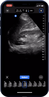 Butterfly iQ3™ Portable Ultrasound Device – 1 or 2 Probes