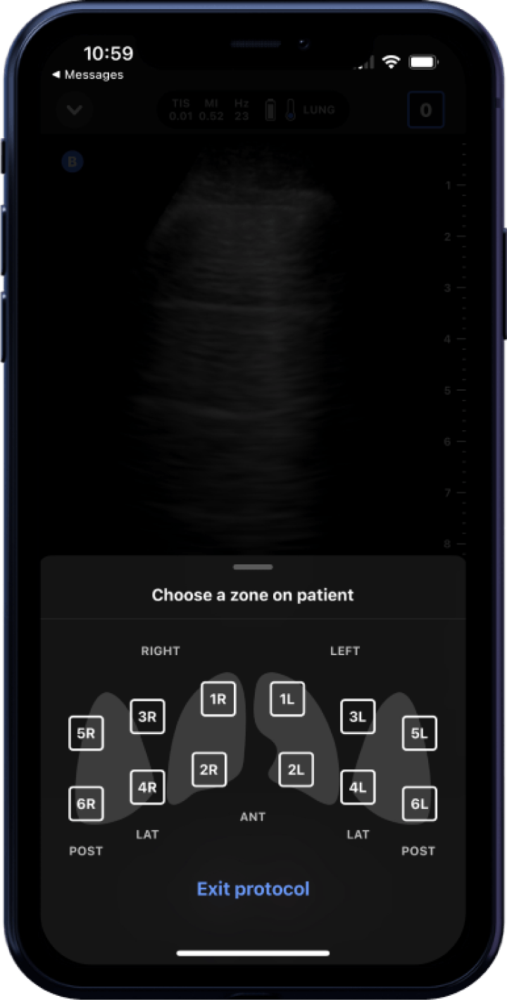 Butterfly iQ3™ Portable Ultrasound Device – 1 or 2 Probes